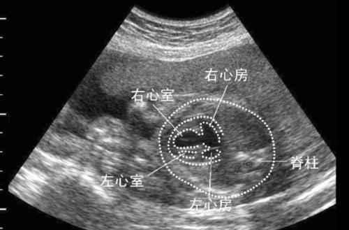 胎儿28周了四维图一出准妈懵了医生再一问一家人脸都绿了