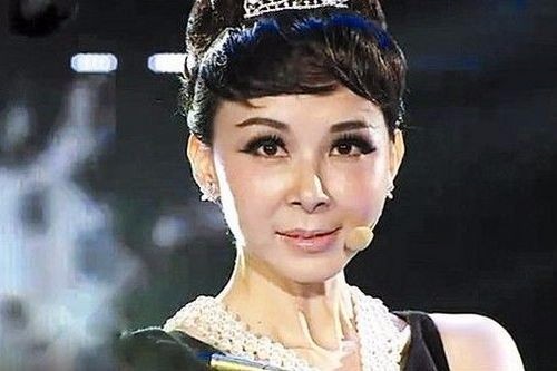 整容需谨慎，看看娱乐圈整容失败的女明星们|整容|娱乐圈|女明星_新浪新闻