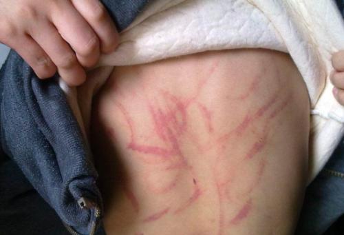 女儿托给婆婆看几天, 回来后满身伤痕, 得知原因后我气愤不已