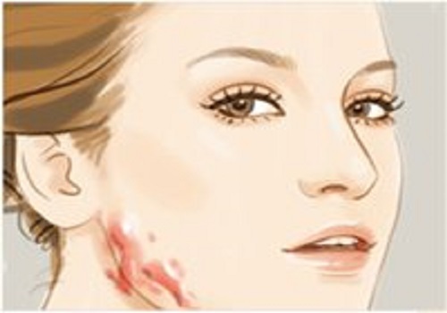 治疗费用其实跟这个有关系,别被骗了|疤痕修复|疤痕|祛疤_新浪新闻