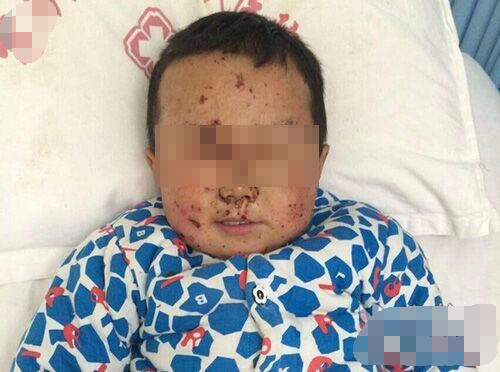 4岁男童家中玩耍割掉鼻子,得知真相后,愤怒的爸爸把家给拆了!