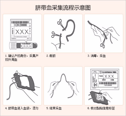 生命银行讲解保存脐带血对宝宝有哪些益处