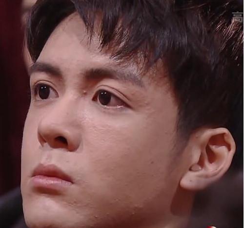 小鲜肉露额头近距离看满脸痘痘令人唏嘘