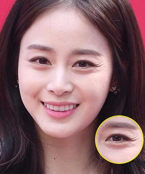 爱笑的女生运气佳 只要笑眼不要笑纹