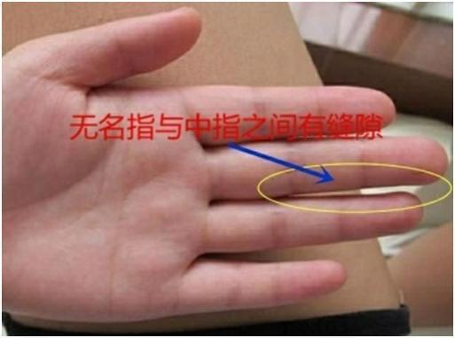 三角纹,菱形纹,钻石纹都是非常富贵的手相,你有哪一个?