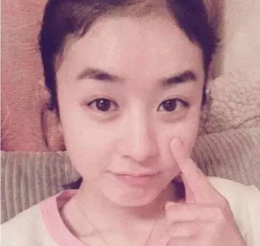 赵丽颖的发际线是怎么变得圆润平整的?