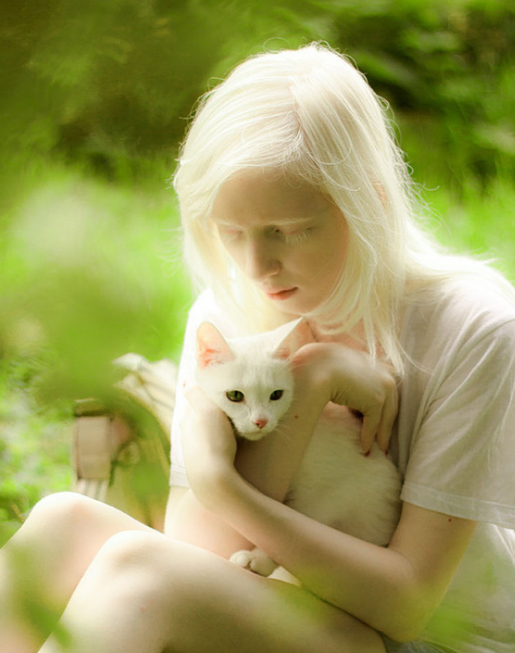 乌克兰女孩患罕见白化病全身雪白,从小遭人嘲笑,如今成模特!