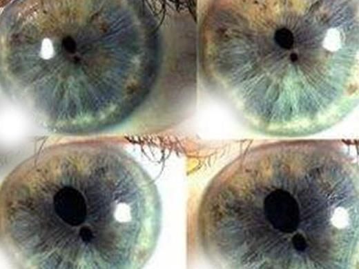 揭秘史上六位真正的重瞳子现代先天性瞳神畸形成古代圣人标志