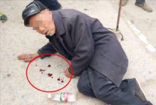 老人口吐鲜血倒地,医生一句话众人却对老人的行为不满!