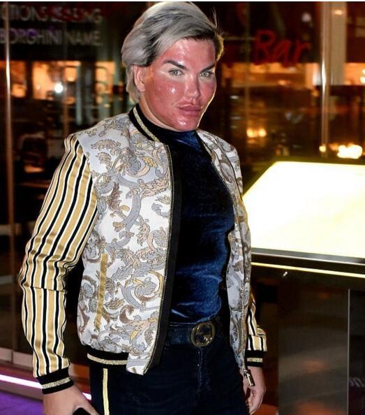 整容狂人现身脸部大面积红肿,自称明年将焕发新生!