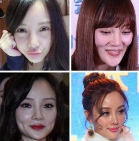 5位整容失败的一线女明星,最后一个吓到我了,建议晚上不要看!