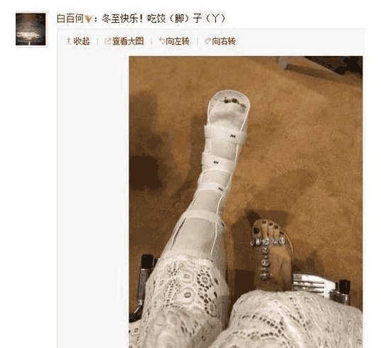 明星风光背后让人疼赵丽颖受伤站不久冯绍峰更是腿骨断裂