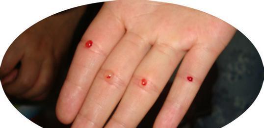 家中给孩子做的手法一共有两个,也是临床上常用的治疗小儿疳积的手法