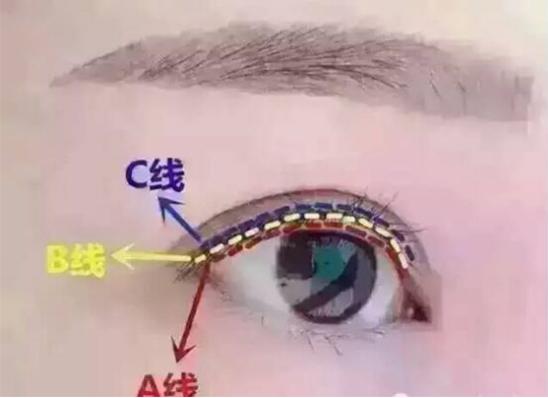 你知道眼线,睫毛线,美瞳线的区别吗?