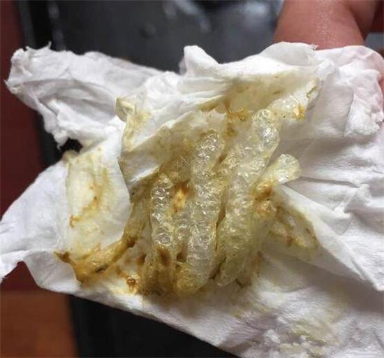 几天不吃不喝,送去医院检查的时候,拉出来的东西太奇葩了?