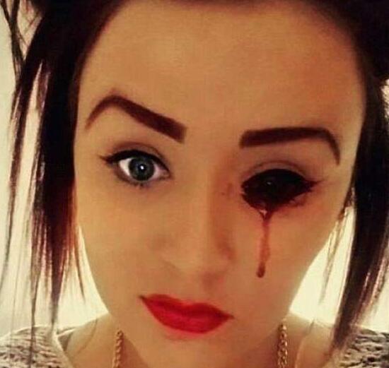 女孩检查身体都正常,但是眼睛却莫名流血,至今原因仍是个谜!