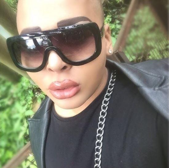 男子追星成瘾,花费110万元整容成偶像的模样,结果变"香肠嘴"