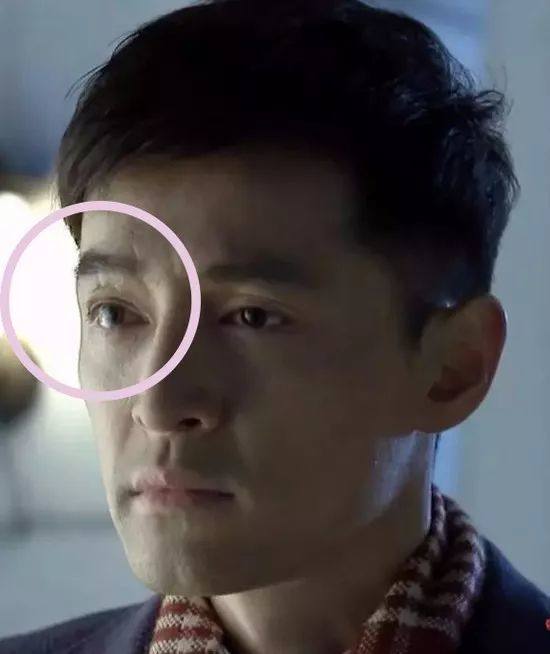 这10位明星脸上都有疤,郑爽被怀疑整容,杨幂自拍只爱拍半边脸!