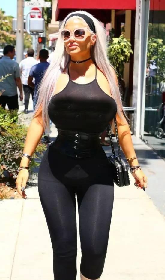 女子为变成"蜂腰",不惜摘除4根肋骨,如今腰围只有47cm