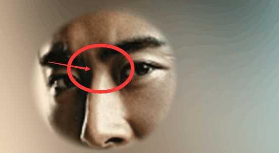 一,山根断,鼻歪斜