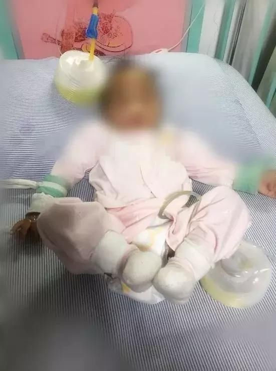 13个月孩子吃了它把肚子撑破了