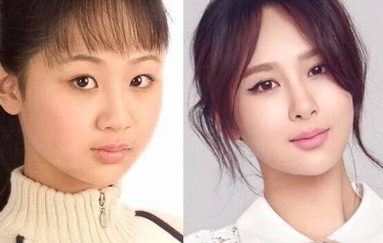 娱乐圈女星出道前,后对比照片差别太大,堪称"换头"!
