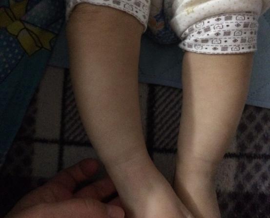 爷爷固执的送给八个月宝宝学步车,却催生了罗圈腿形成!