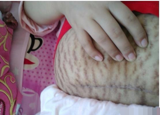 临产前的肚子图片图片