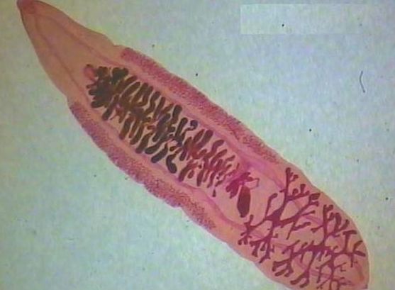 身体出现这几种症状,万万别再忽视了,说明你体内有虫子