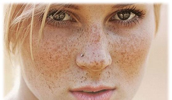 采用蛋清配上蜜糖,能让你补充脸部水分,柔嫩肌肤,从而淡斑成功