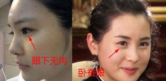 饭勺面相口诀:眼下无肉,子女不足,眼睛有这个特征的人子嗣难旺