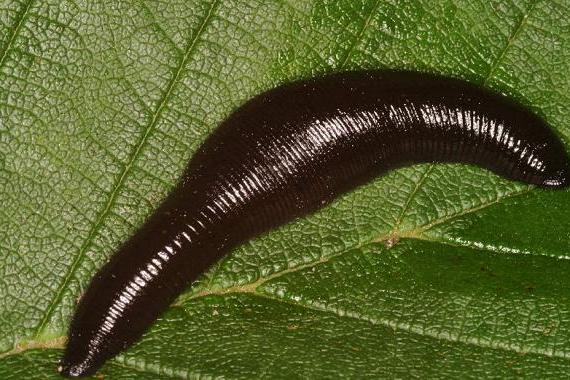 古人医疗技术"高明":手段残忍,竟用水蛭吸血