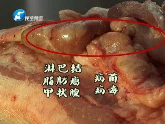 猪脖子上的肉太脏不能吃?这里的毒素高温都无法消灭!脏!