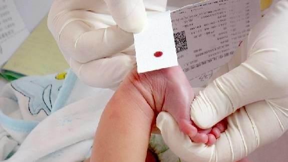 抽足跟血是检查什么病? 新生儿为什么都要做