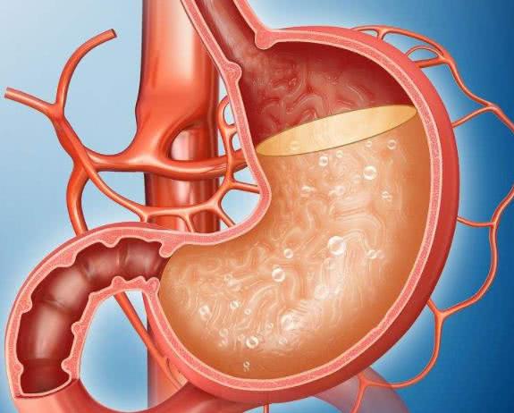 "胃里感染一种菌,癌症悄悄找上你",趁早补救用3招!