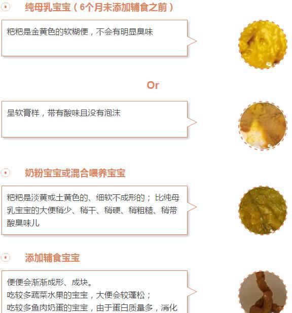 绿便,奶瓣,拉稀…这些粑粑正常吗?