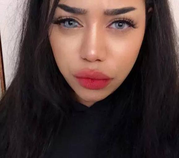 出生就自带美瞳,因胎记长眼睛里被称女神,最美胎记什么样?