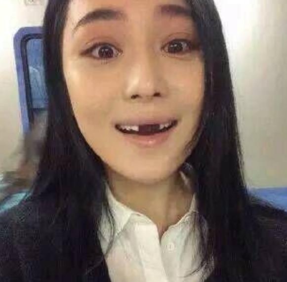 美女,你的牙是磕在台阶上了么