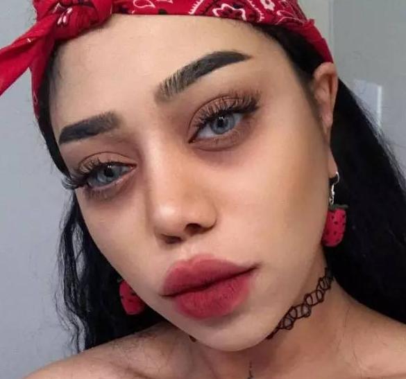 出生就自带美瞳因胎记长眼睛里被称女神最美胎记什么样