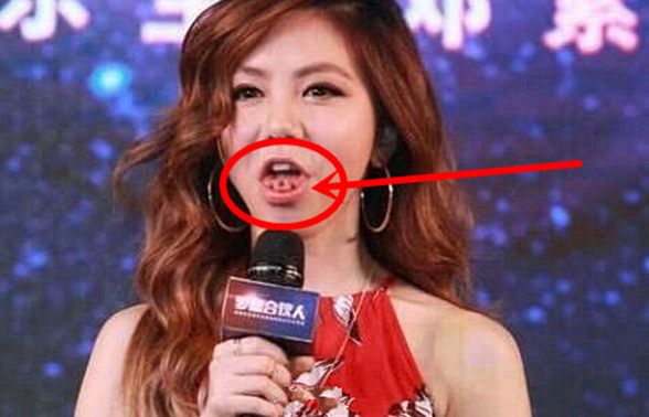 邓紫棋作为一位歌手,也有自己的神技能!如上图,她的舌头这是怎么了?