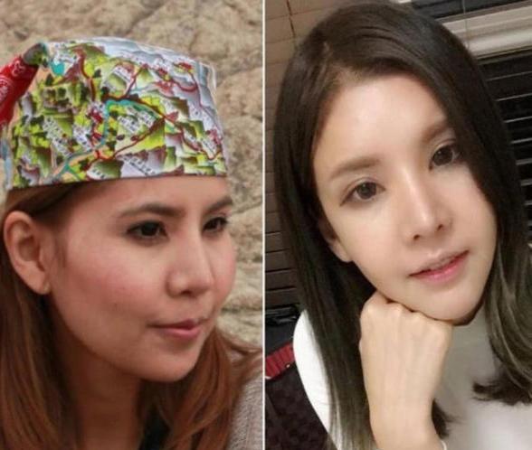 整容40次,丑女变女神,爱情事业双丰收,堪称整容界的励志传奇!