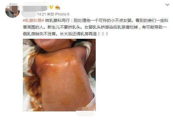 孩子|奶头|习俗_新浪新闻