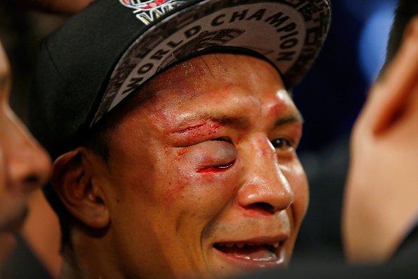 最恐怖的拳击受伤有人被打掉一只耳朵更有人被差点打掉嘴唇