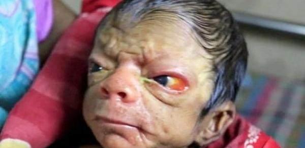 新生儿一身皱纹像70岁老头,可父母的举动令人痛心