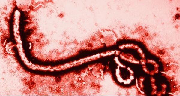 世界上10大最恐怖的病毒,第一让近数亿人死亡