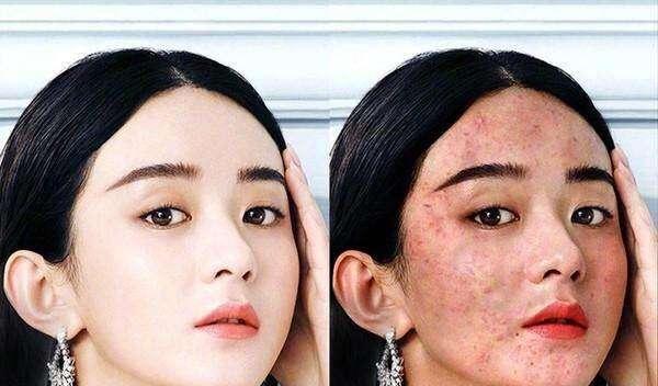 迪丽热巴赵丽颖变丑女?全怪无良商家!