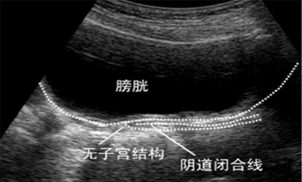 结婚快一年才发现自己的妻子是石女现在真的很后悔