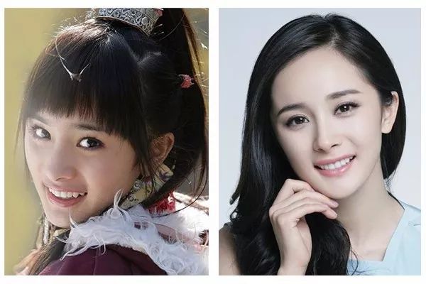 杨幂&杨颖两大当红话题女星,都以牙齿矫正来回应整容质疑,一路星途