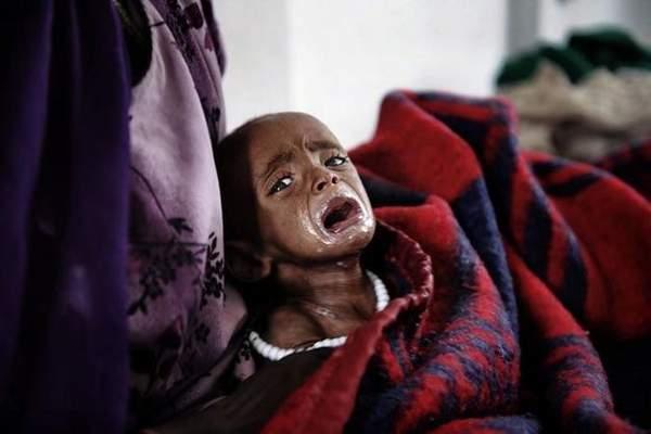 非洲|饥饿|儿童_新浪新闻