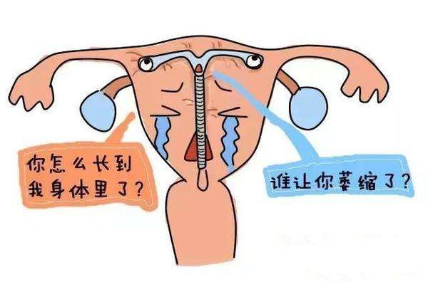 明知上环有那么多危害但为什么一些女性还要遭这份罪受呢